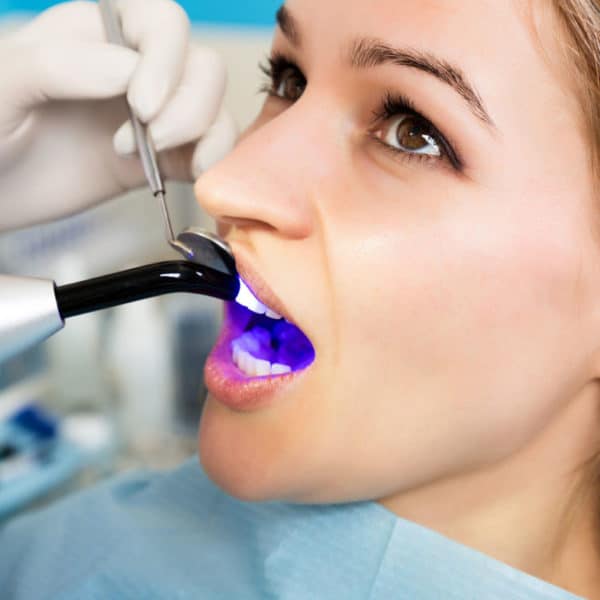 How Dental Bonding Can Eliminate Gaps in Teeth