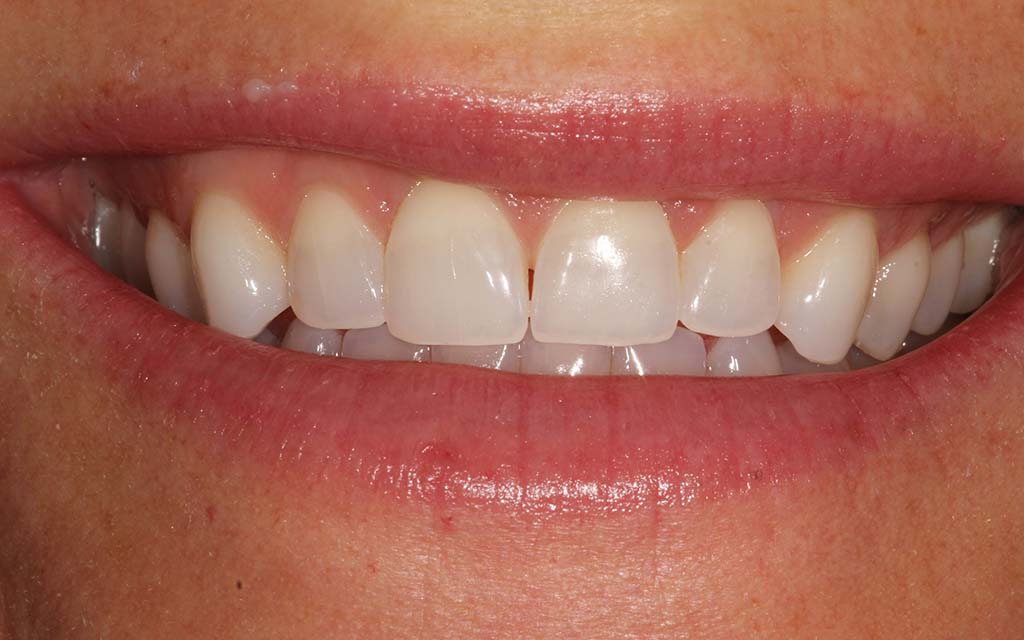 Smile Gallery Houston Dentists at Post Oak