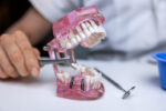 Multiple Missing Teeth